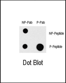 Phospho-MAP3K1(T1383) Antibody
