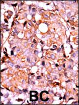 Phospho-RAD9(S387) Antibody