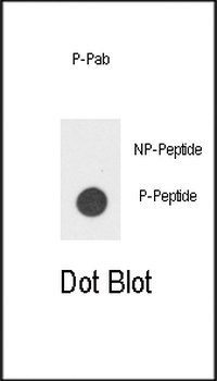 Phospho-IL3R(Y766) Antibody