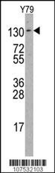 ABL2 Antibody (R432)
