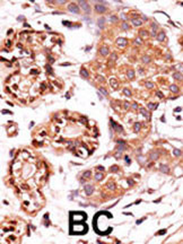 Phospho-ABL1(Y393)/ABL2(439) Antibody