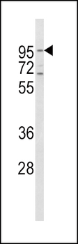 CD71 Antibody (C-term)