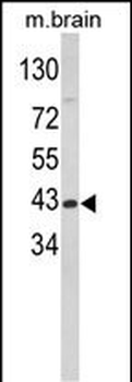 GOT1 Antibody (N-term)