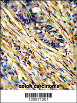 YWHAG Antibody (Center)