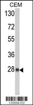 PRDX6 Antibody (C-term)