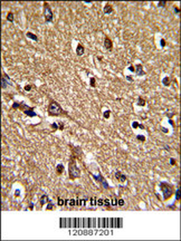 PRDX2 Antibody (Center)