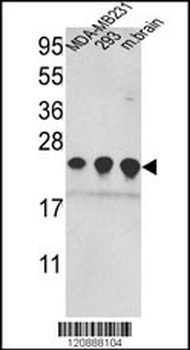 PRDX2 Antibody (C-term)