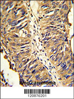 PDIA3 Antibody (Center)