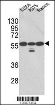 PDIA3 Antibody (Center)