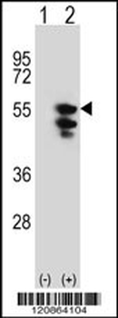 TUFM Antibody (N-term)