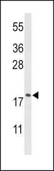 CFL1 Antibody (Center)