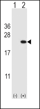 CFL1 Antibody (Center)