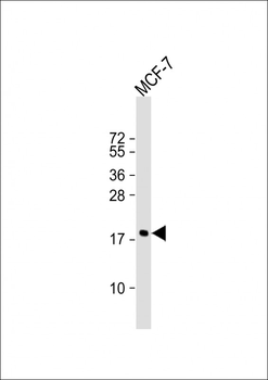 CFL1 Antibody (Center)