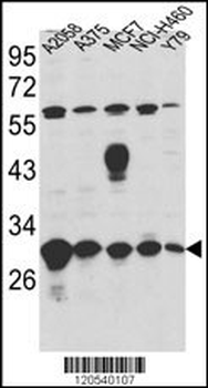 ERP29 Antibody (Center)