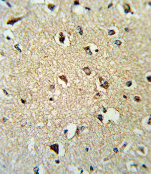 ARHGDIA Antibody (C-term)