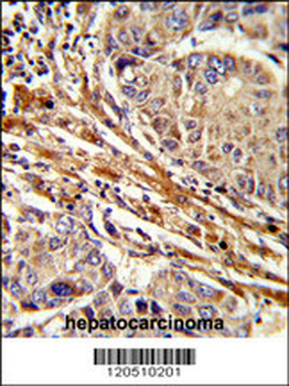 APRT Antibody (C-term)
