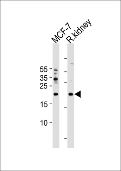 APRT Antibody (C-term)