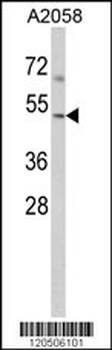 ACTR3 Antibody (C-term)