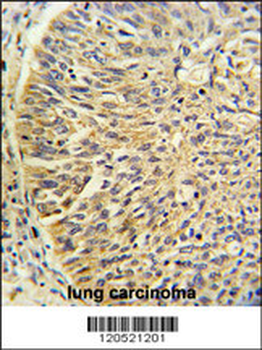 CCT3 Antibody (Center)