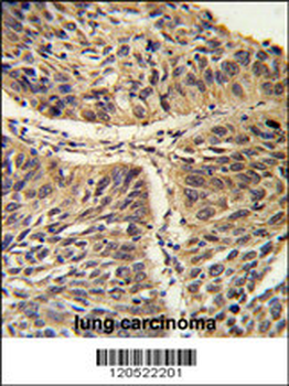 CCT3 Antibody (C-term)