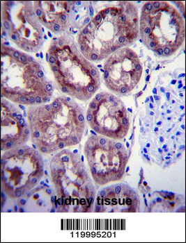 ENOA Antibody (C-term)
