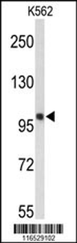 HSPH1 Antibody (Center)