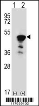 FEN1 Antibody (Center)