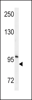 ENPP2 Antibody (Center K416)