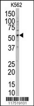 POLG2 Antibody (Center)