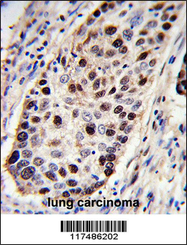 PCNA Antibody (C-term)