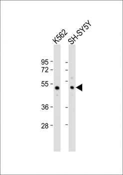 SMPD2 Antibody (N-term)