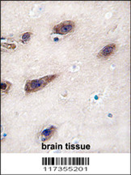 STX3 Antibody (Center)