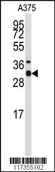 STX3 Antibody (Center)