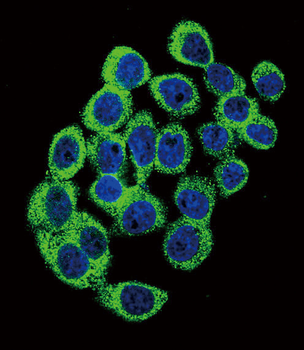 ATXN1 Antibody (S776)