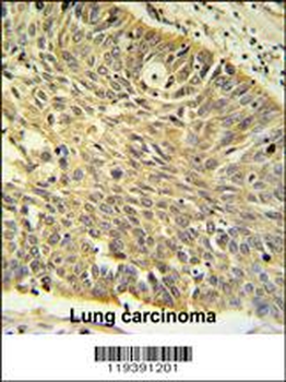 MTHFD1 Antibody (Center P550)