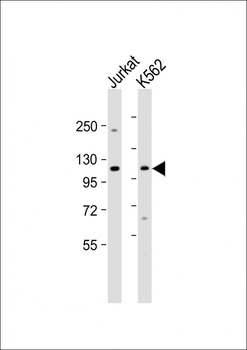 MTHFD1 Antibody (Center P550)