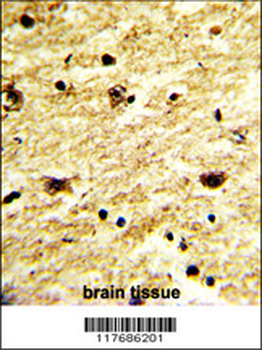 EXOSC8 Antibody (C-term)