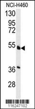 HNF4A Antibody (S142)