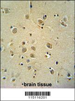 ZIC3 Antibody (Center)