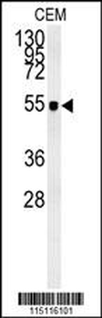 ZIC3 Antibody (Center)
