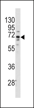 FZD1 Antibody (Center)