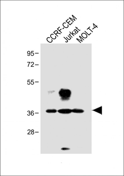 TAL1 Antibody (T90)