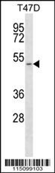 MCT1 (SLC16A1) Antibody (C-term)