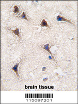 SEMA6A Antibody (C-term)