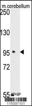 SEMA6A Antibody (C-term)
