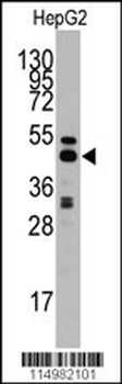 S adenosylhomocysteine hydrolase (ACHY) Antibody (C-term)