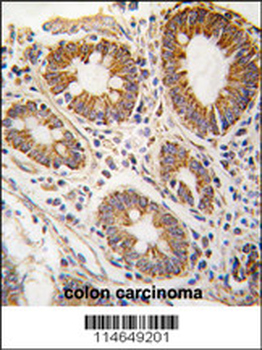 S adenosylhomocysteine hydrolase (ACHY) Antibody (N-term)