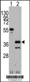 ZIC4 Antibody (C-term)