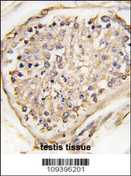 NPTX2 Antibody (C-term)