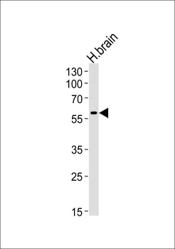HERV (ERVWE1) Antibody (Center)